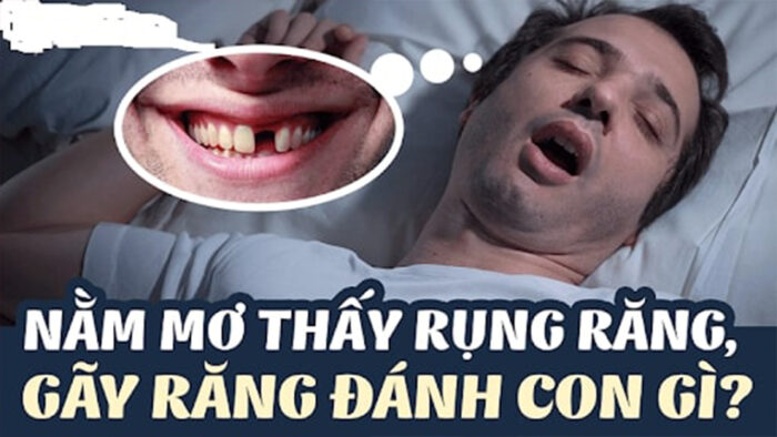 Ngủ mơ thấy gãy răng chảy máu đánh đề số gì?